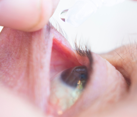 age-related-macular-degeneration